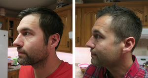 Nick-Shell-before-and-after-using-rosemary-oil-for-hair-loss-reduction.jpg