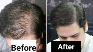 rosemary-oil-for-hair-before-after.jpg